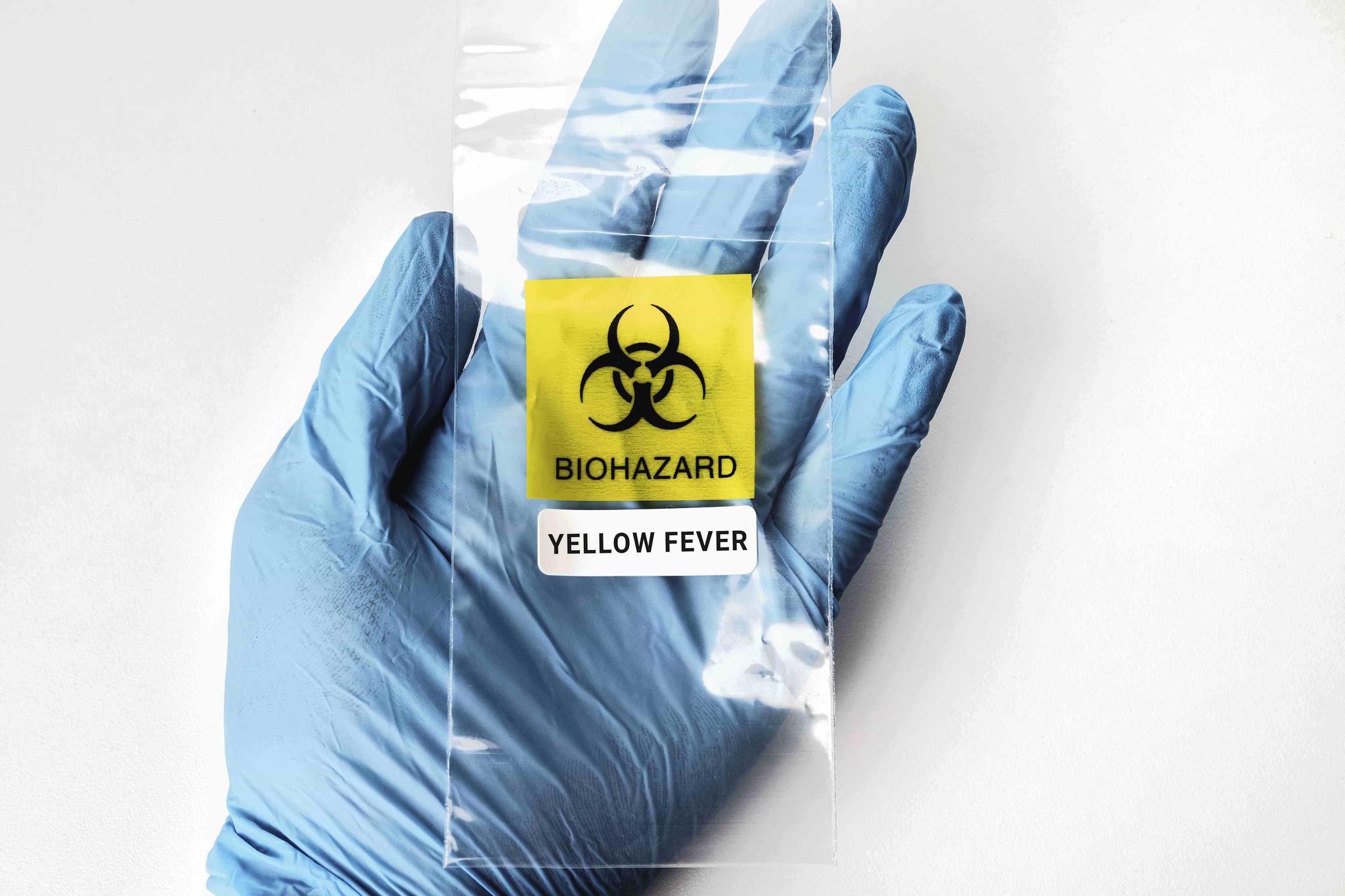Do I Need a Yellow Fever Certificate to Enter Tanzania?